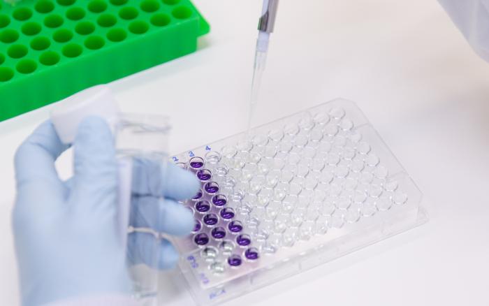Gloved hands pipetting liquid in HIV lab