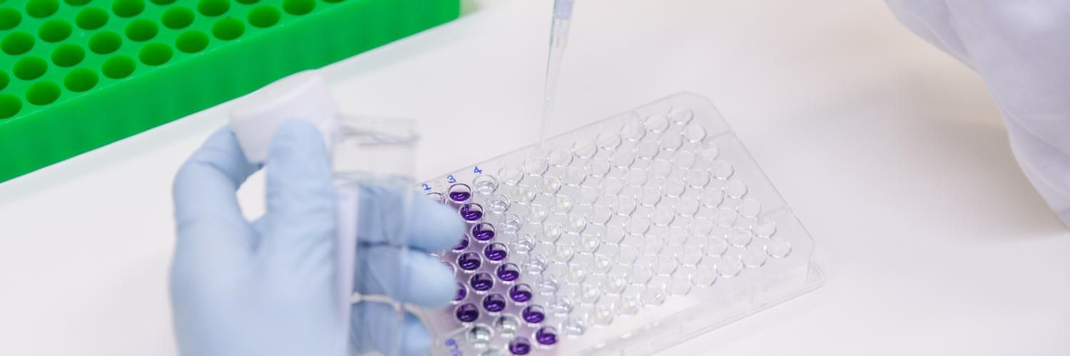 Gloved hands pipetting liquid in HIV lab