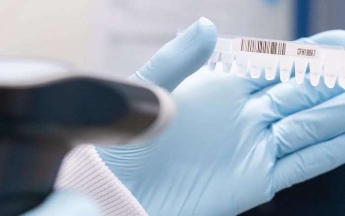 A hand holding a tray of samples being tested for COVID-19.