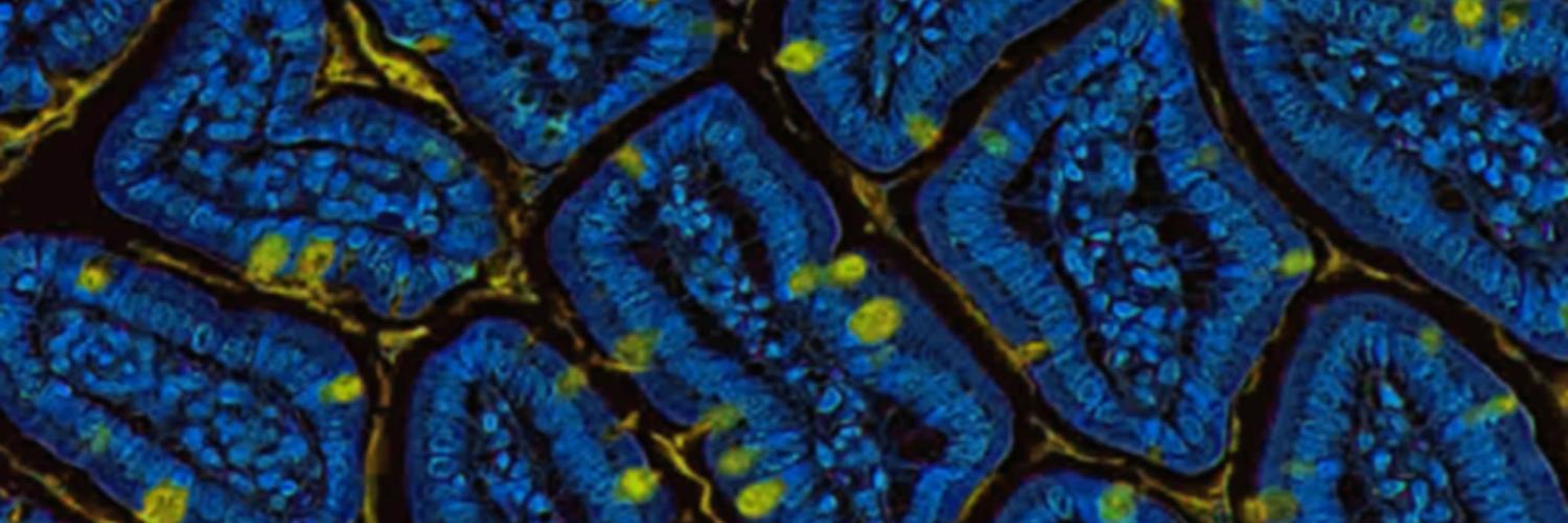 A section of intestinal tissue with mucus-producing cells.