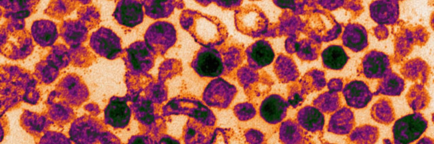 Electron microscope image of mouse leukaemia virus-like particles containing a faulty p12 protein.