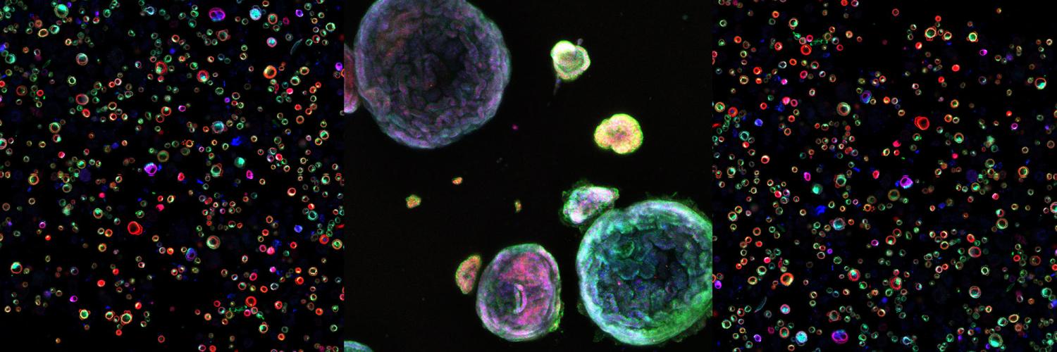 Cells freshly isolated from a human thymus and human pancreatic organoids growing in culture.