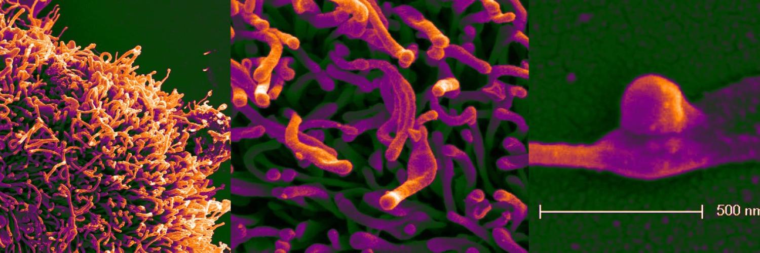 Three images of cells and cell surfaces