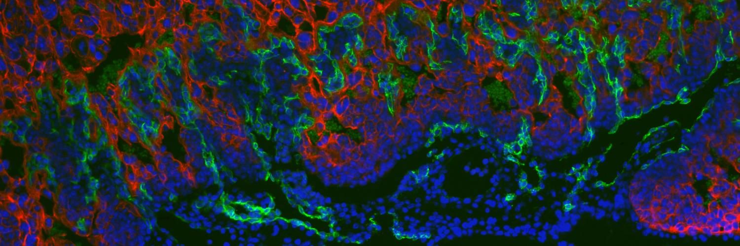 groups of red, green and blue blobs swirling around a black background