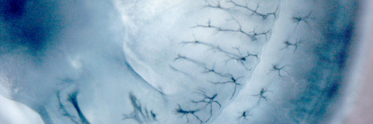 2H3 Neurofilament whole-mount Immunohistochemistry staining of E12.5 mouse embryo performed by Bradley Spencer-Dene of the EHP lab