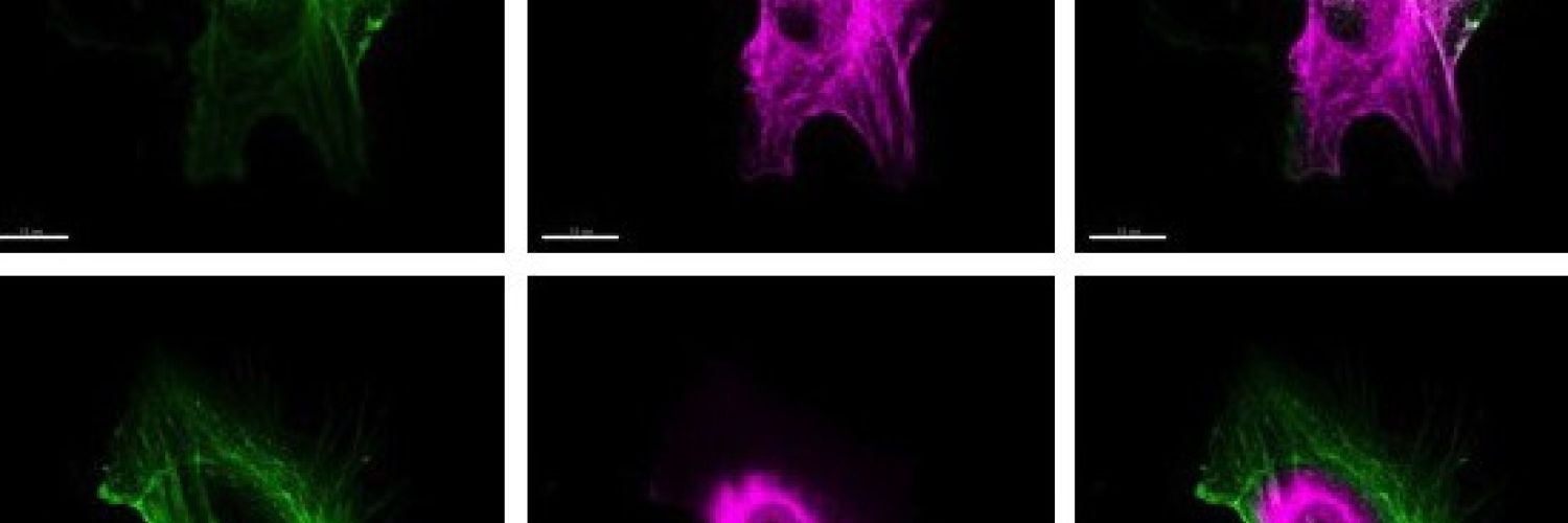 HeLa cells with and without f-actin antigen