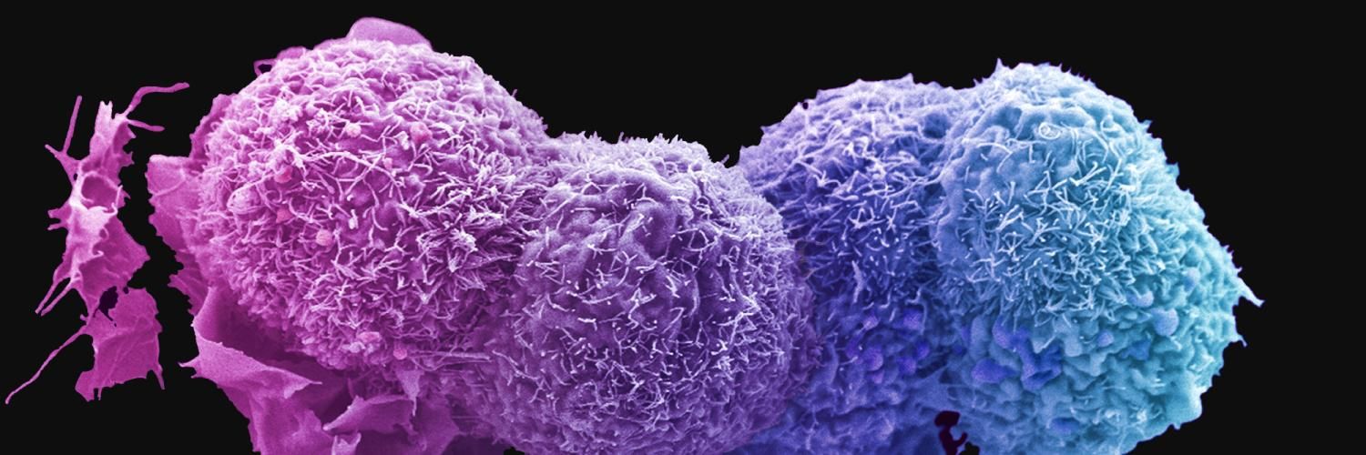 Electron microscopy image of lung cells