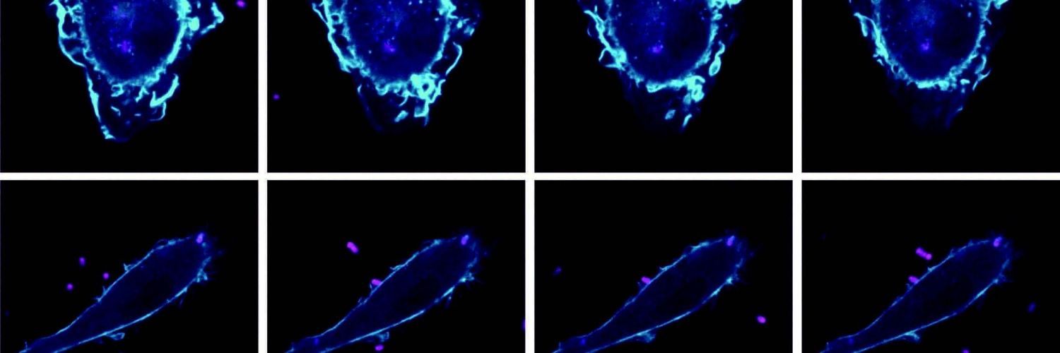 Macrophages with and without ARPC5