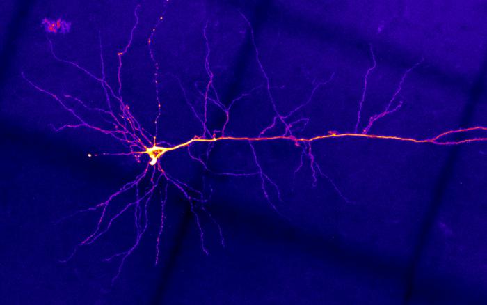 An illuminated neuron on a dark purple background.