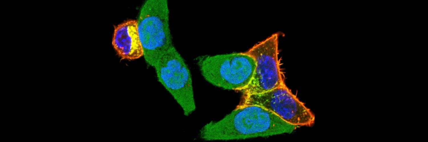 Autophagy (self-eating) protein in green is targeted to unusual destinations by a flu protein in red.