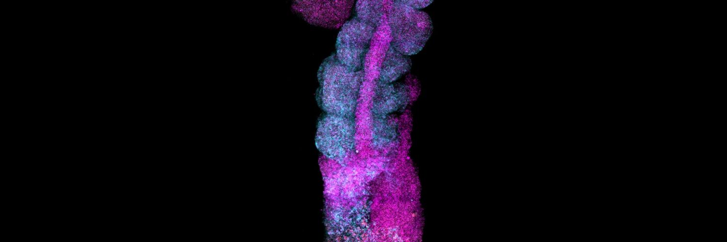 Neural tube and somites