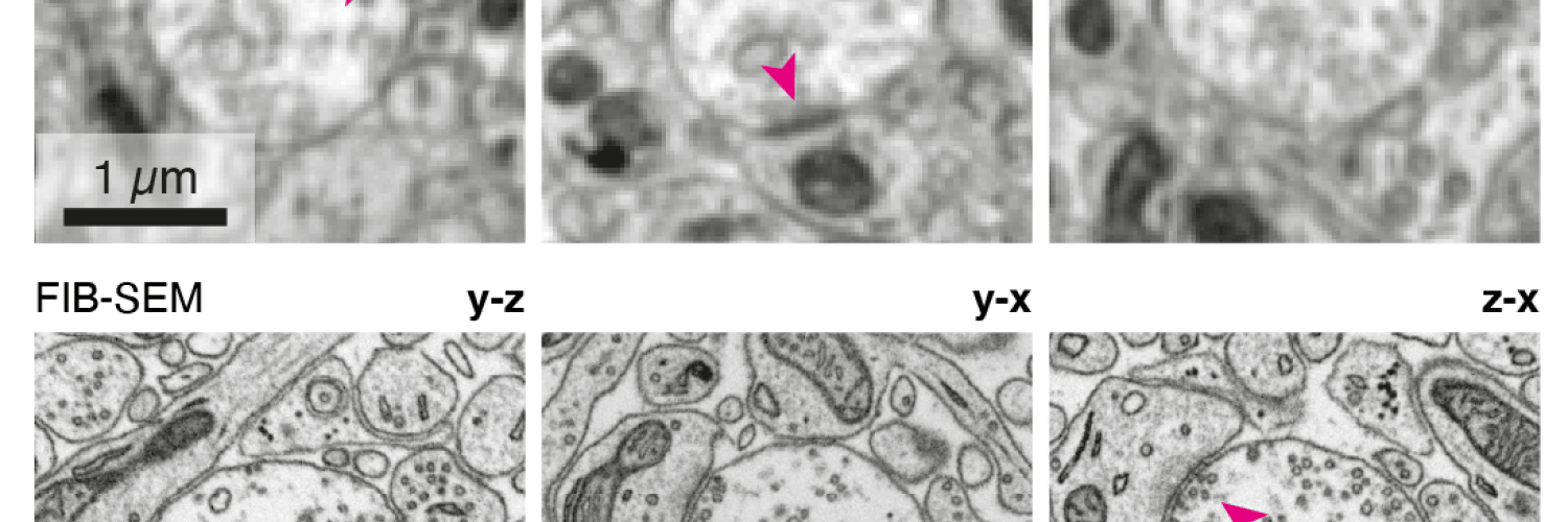 Volume EM and X-ray imaging 