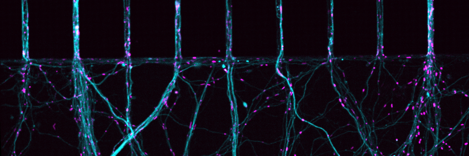 Blue vertical strands that branch out with pink dots along them against a black background