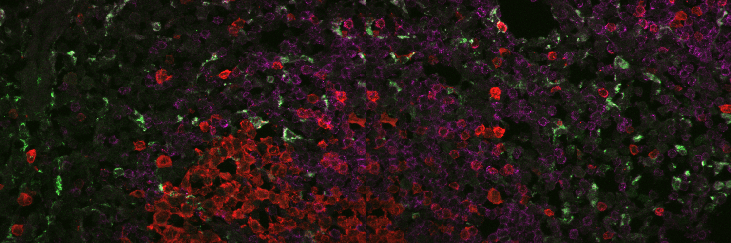 A spleen tissue cross-section.