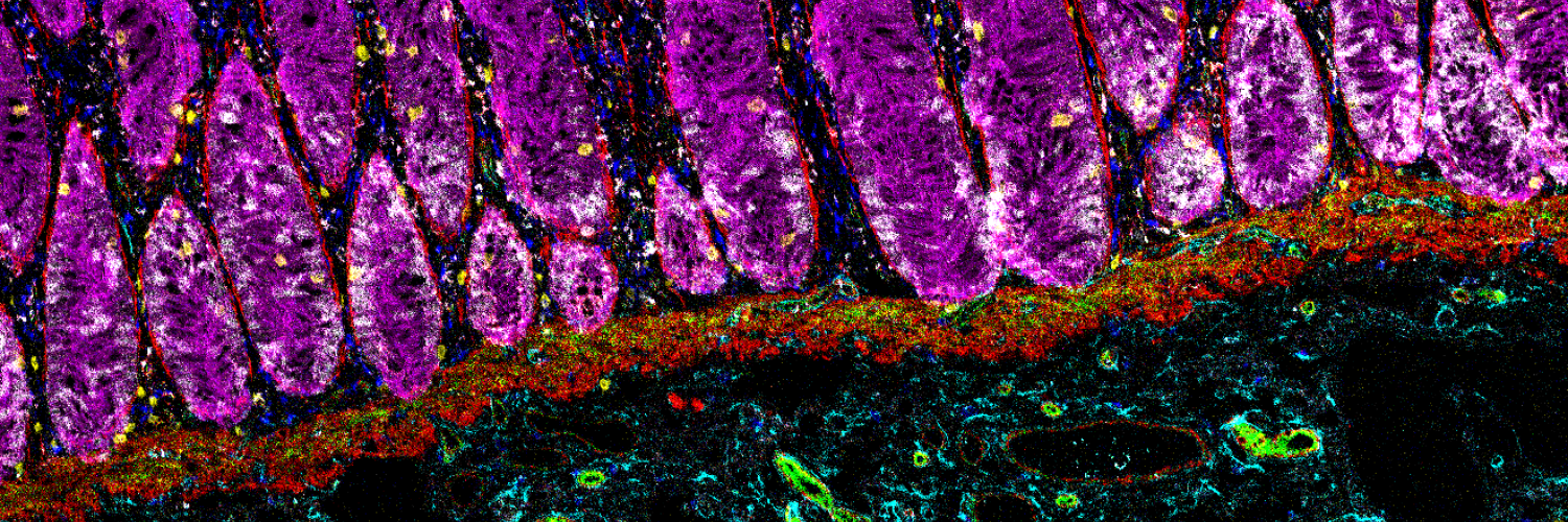 Colon mucosa with the distinctive organization in glandular structures formed of epithelial cells
