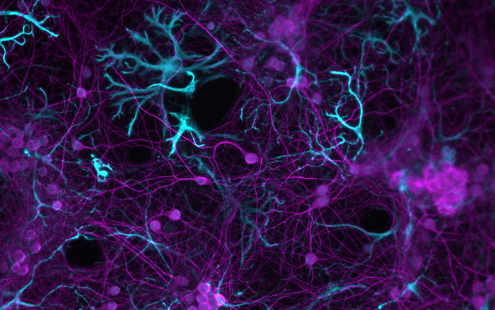 Neurons (in purple) and astrocytes (in light blue)